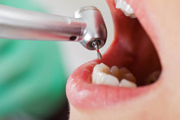Best Emergency Root Canal Treatment in Emerald Lakes, PA